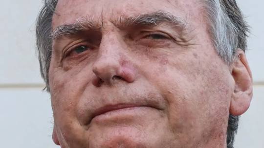 Bolsonaro segue  internado na Unidade de Terapia Intensiva (UTI)